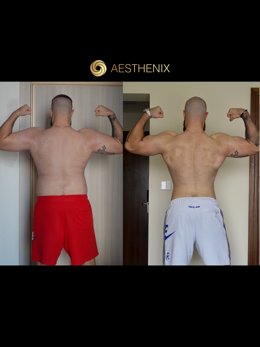 Александр после